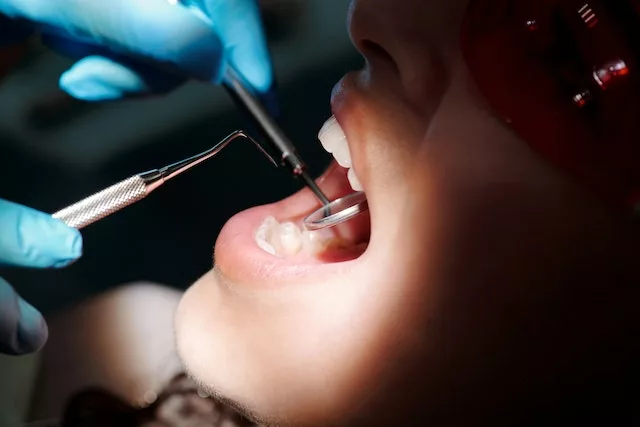 Wel of geen tandartsverzekering? | Tandarts verzekering afsluiten?